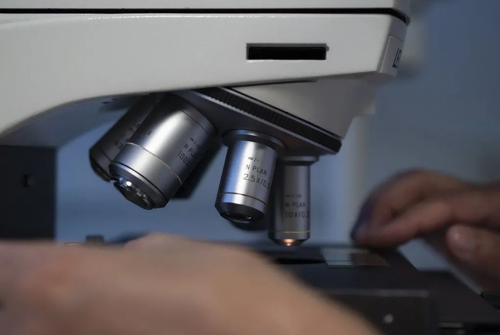 ¿Cuál es el impacto de la biotecnología en la industria alimentaria para startups?